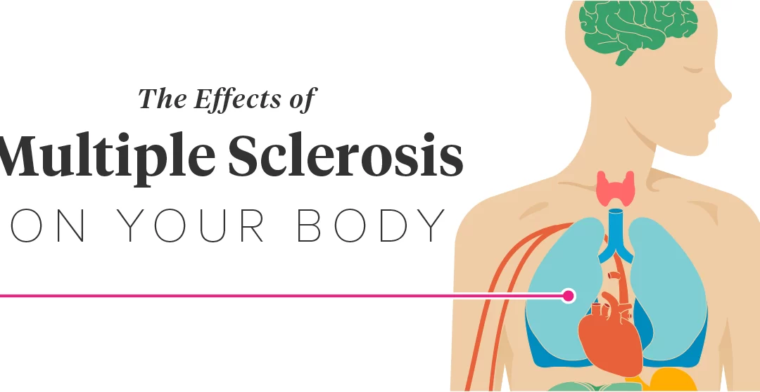 Complications of Multiple Sclerosis