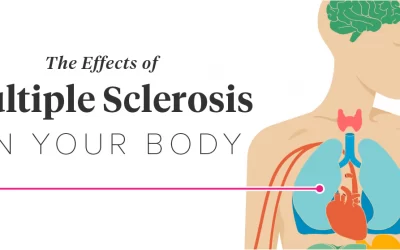 Complications of Multiple Sclerosis